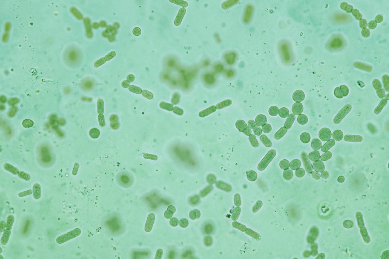 Brève Histoire des Législations sur les Produits Biocides en Turquie